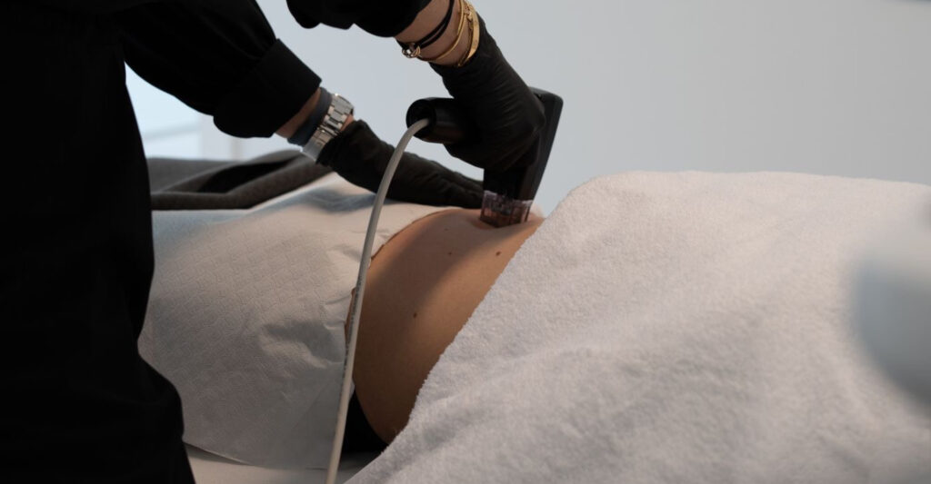 Morpheus 8™ at Skin Atelier Kilchberg